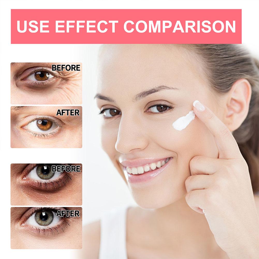 Retinol Eye Cream Lightening D - The Ordinary Serum Hyaluronic Acid ulasan dan harga